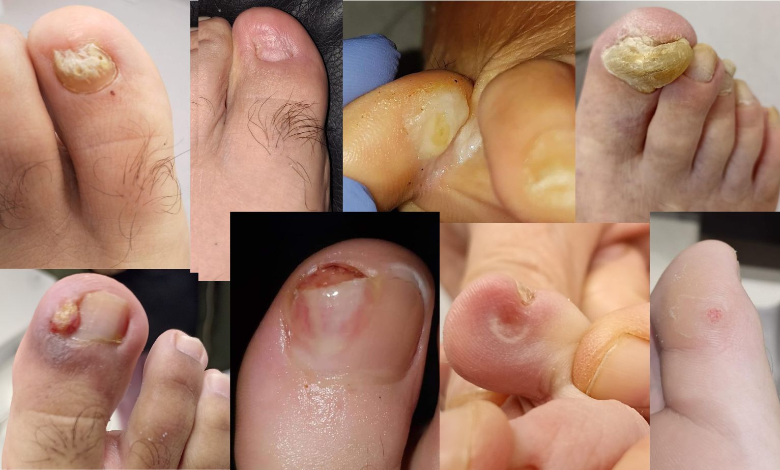 Patologías del pie